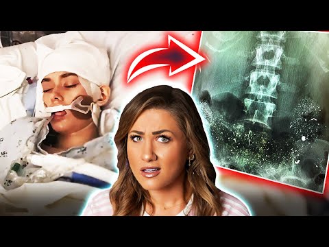 She Was Poisoned With Lead... But Survived: The Hannah Pettey Case