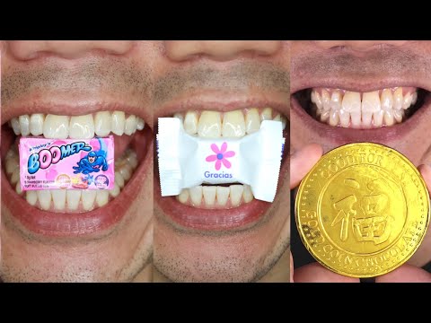 Satisfying Chewing ASMR #Compilation #ASMR #DoctorTristanPeh