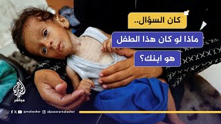 الشارع العراقي يتفاعل مع صور طفل مجوع في غزة