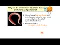 Worm Anatomy and Symmetry Concepts