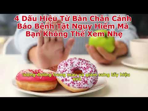 4 Dấu Hiệu Từ Bàn Chân Cảnh Báo Bệnh Tật Nguy Hiểm Mà Bạn Không Thể Xem Nhẹ