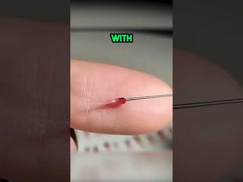 This is INSANE! Berry Surgery! 🤯