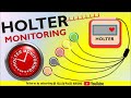 Holter Monitoring Concepts and Procedures