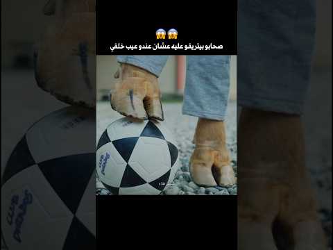 شاب عندو عيب خلقي رجلو زي الحيوانات 🥺 #shorts