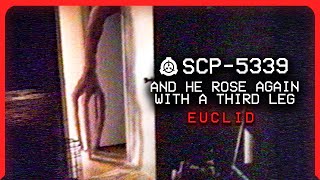 SCP-5339 │ And He Rose Again With a Third Leg │ Euclid │ Alive/Humanoid SCP