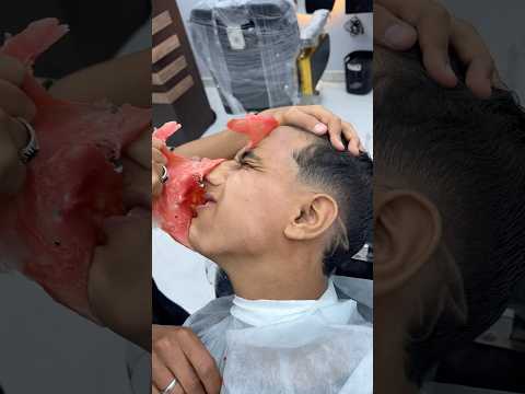 ازالة الشعر المتسلطن م الوجه ✂️🥵 #fyp #foryou #foryoupage #viral #explore #comedy #asmr