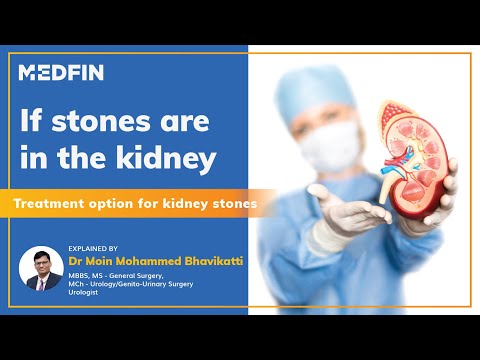 Treatment options for Kidney stones