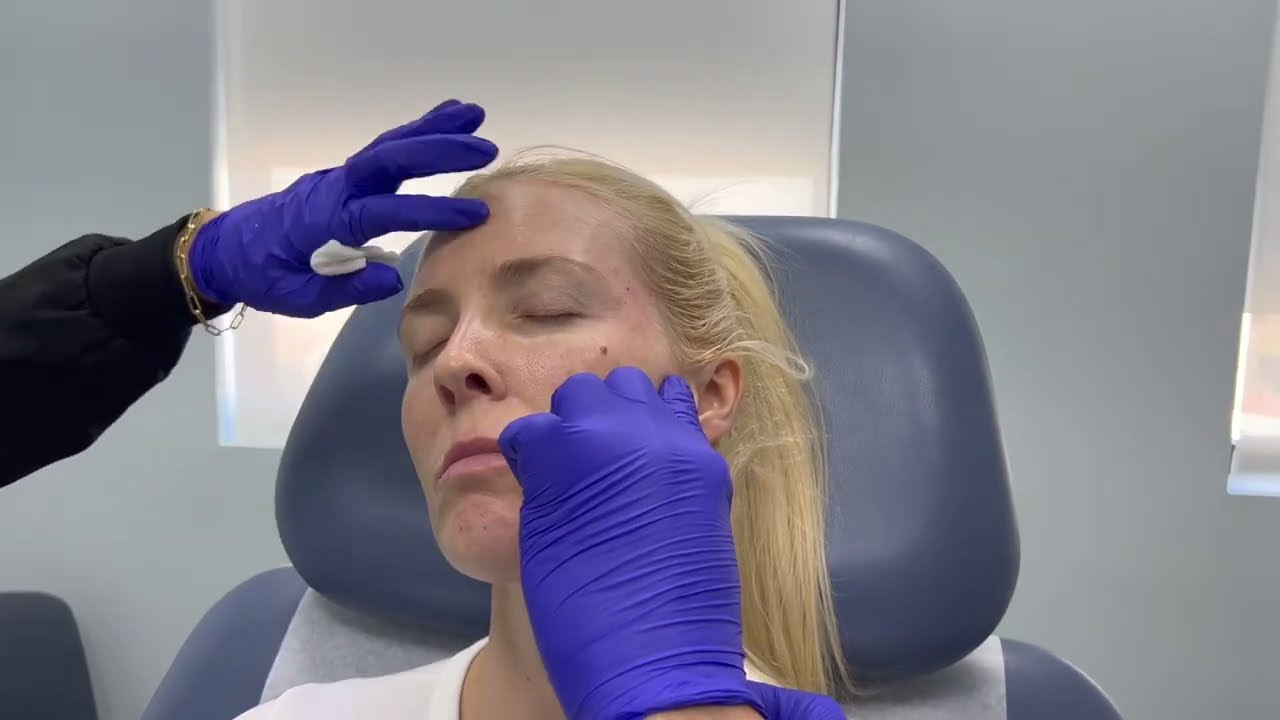 Woman with markings for cosmetic procedure preparation.