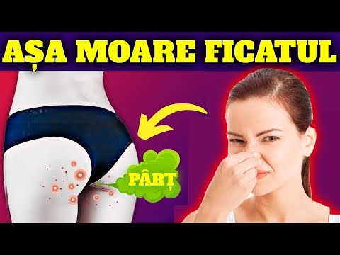 SEMNE ALARMANTE CĂ FICATUL TĂU ESTE PE MOARTE