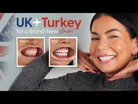 Complete Smile Makeover at Dentakay: Claudia’s Journey from the UK