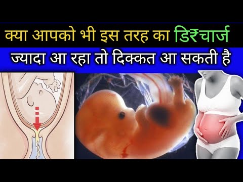 क्या आपको भी इस तरह का डि₹चार्ज आता है तो सावधान रहे