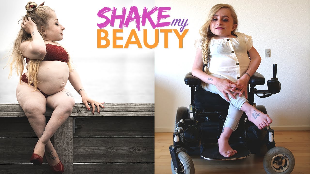 My bones of glass won't stop me modelling - shake my beauty