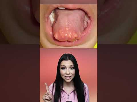 YOU SHOULD NEVER LICK ENVELOPES ๏ฟผ