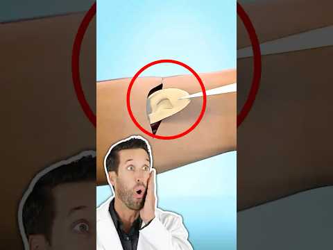 ER Doctor REACTS to Growing an Ear in Your Arm (Zack D.  Films)