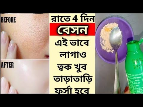 শীতে  বেসনে এটা মিশিয়ে ৪দিন মাখো ত্বক ফর্সা,উজ্জ্বল টানটান হবে। কালো দাগ দূর হবে।skin Whitening