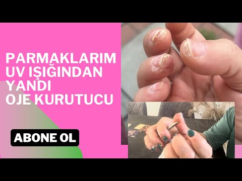 ELLERİM UV OJE KURUTUCUDA YANDI #nails #video #keşfet #kalıcıoje