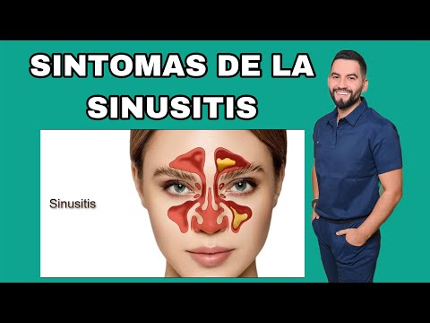 SINTOMAS DE LA SINUSITIS | DR. DAVID CAMPOS