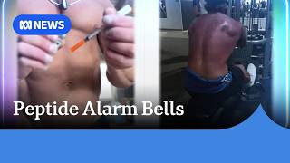 YouTube video thumbnail: Abnormal Moles Seen Developing in Patients Using Peptide Melanotan-II
