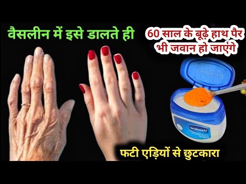 वैसलीन में इसे डालते ही 60 साल के बूढ़े हाथ पैर भी जवान हो जाएंगे😊hand soft, wrinkle free,smooth,