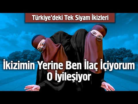İkizimin Yerine Ben İlaç İçiyorum O İyileşiyor - Siyam İkizleri