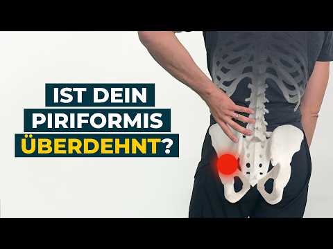 Piriformis Ischialgie Schmerzen durch Schneidersitz? Diese Übung hilft!