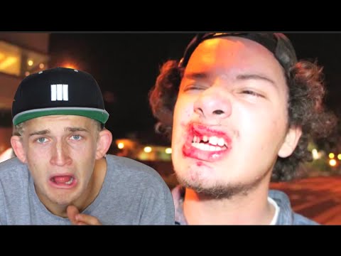 Reacting to Bad Skateboarding Fails!