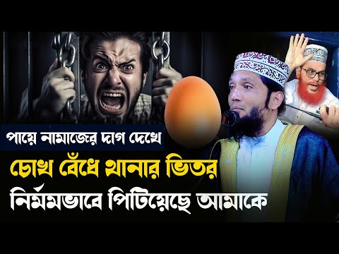 নামাজ পড়ার কারণে পুলিশ চোখ বেঁধে নির্মমভাবে পিটিয়েছে আমাকে ।মুফতি কুতুব উদ্দিন 01724619758 ।