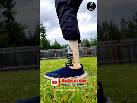 Man Builds His Own Prosthetic Leg | Inspiring Journey of Hope" #nevergiveup #limbloss