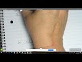 Solving Linear Equations and Fractions