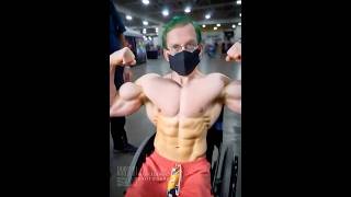 Josh Twelves flexing his muscles #arthrogryposis #arthrogryposismultiplexcongenita #disability