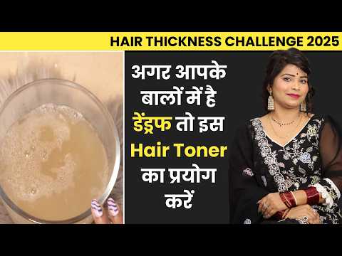 This Winter Season You Can Achieve *Extreme Hair Thickness* This Toner How To Make At Home