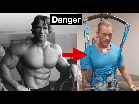 From Greek Gods to Failed Human Experiments | Bodybuilding's Tragic History