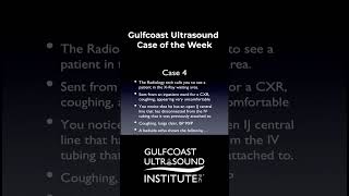 Ultrasound Case Study of the Week 4