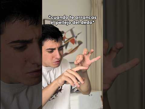 CUANDO TE ARRANCAS EL PELLEJO DE UN DEDO 💀 #shorts