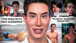 THE MAN WHO COULDN'T STOP GETTING SURGERY...