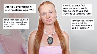 Answering All Your Questions... Q&A
