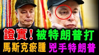 證實！被特朗普打 ! 馬斯克瘀腫 兇手特朗普 ! / 新潮民 @SCM1.0