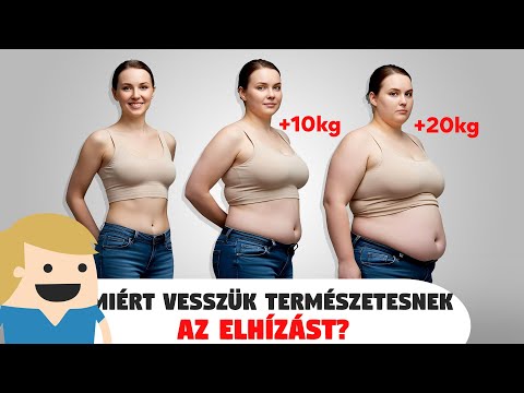 Miért vesszük az elhízást természetesnek?