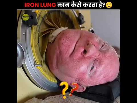 How Does an Iron Lung Keep You Alive? 😧