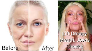 Get Rid Of Laugh Lines, Lip Wrinkles, Saggy Jowls & Cheeks, Lift Mouth Corners Exercise & Massage