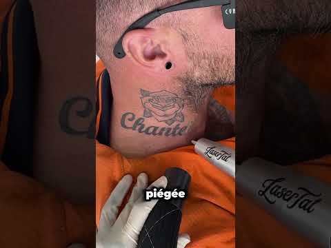 Comment les tatouages s'estompent ils
