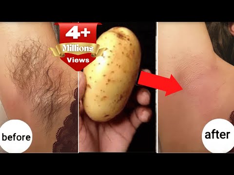 stop shaving! here s how to permanently get rid of facial, body and pubic hair