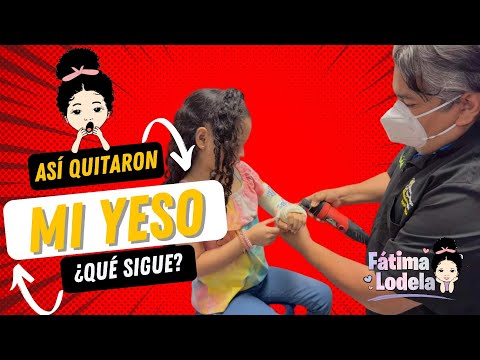 Me retiraron el yeso #viral #shorts #trending #larin #funny #fatimalodela #video #short