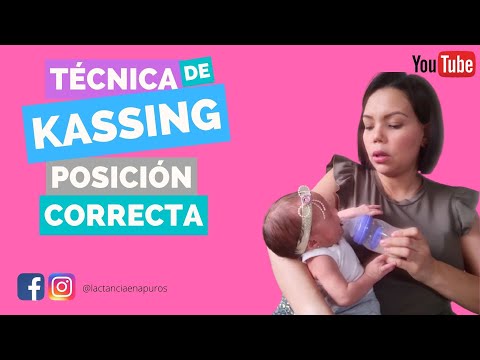 Técnica Kassing posición correcta