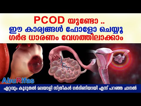 PCOD യുണ്ടോ ..ഈ കാര്യങ്ങള്‍ ഫോളോ ചെയ്യൂ ഗര്‍ഭ ധാരണം  വേഗത്തിലാക്കാം  | CURE  PCOS getting pregnant