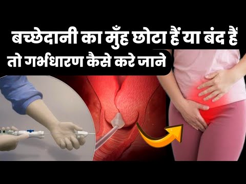 बच्छेदानी का मुँह छोटा हैं या बंद हैं तो गर्भधारण कैसे करे जाने|how to get pregnant fast|pregnancy|