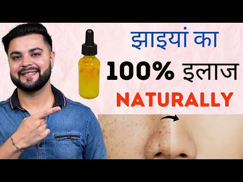 झाइयों का 100% इलाज Naturally: Skin Whitening Pigmentation Treatment