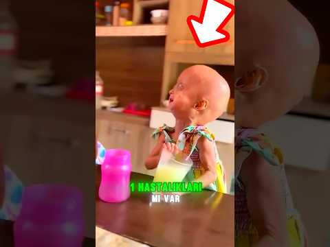 Bu Bebekler Neden Böyle Görünüyor? 😨😥
