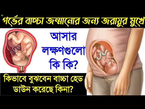 গর্ভের বাচ্চা হেড ডাউন পজিশনে এসেছে কিনা কিভাবে বুঝবেন? | পেটের বাচ্চার মাথা নিচের দিকে নামানোর কৌশল