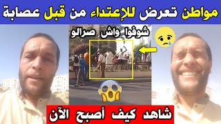 الجزائر 😱😨 شاهد كيف أصبح حال هذا المواطن اليوم بعدما تعرض للإعـ ـتداء من قبل عصابة بولاية أم البواقي